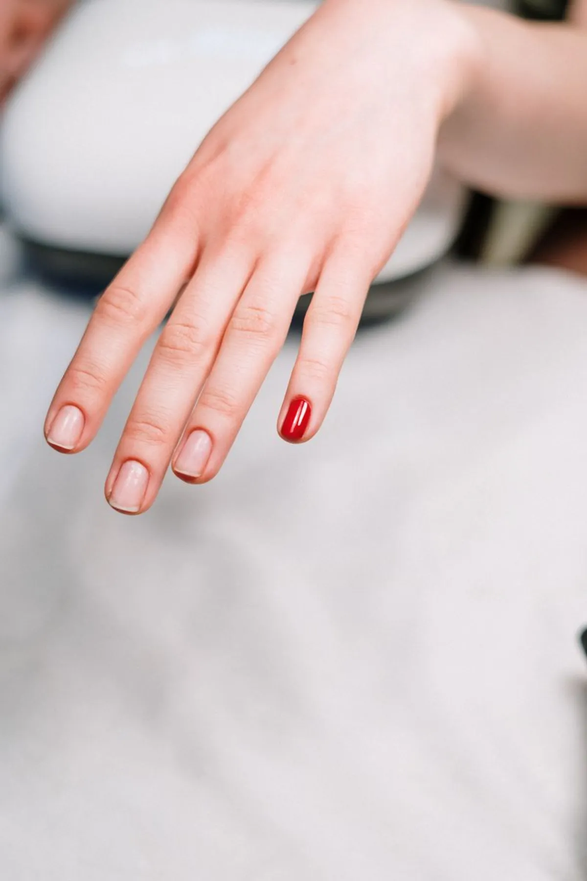 Handpflege – Nagelpilz an den Fingern fällt früh auf und lässt sich gut behandeln